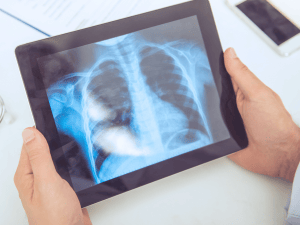 [IMAVIDA] BANNERS EXAMES - 1 TOMOGRAFIA 3 RADIOLOGIA